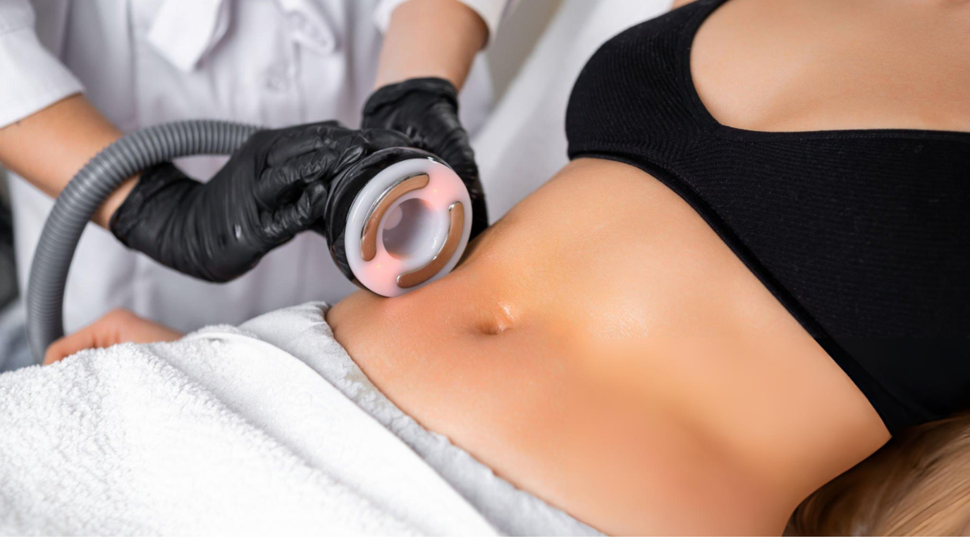 A woman undergoing laser treatment on her abdomen, with a technician operating the device in a medical environment.